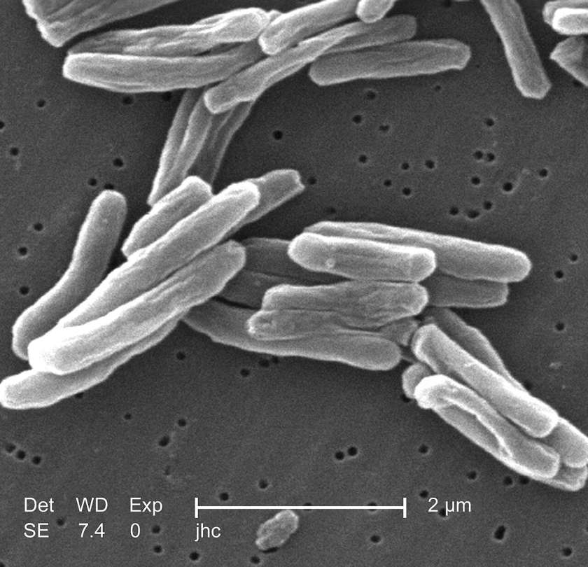 Ultrastructural details seen in the cell wall configuration of a number of Gram-positive Mycobacterium tuberculosis bacteria